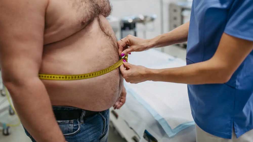 Italia, prima al mondo a riconoscere l’obesità come malattia cronica